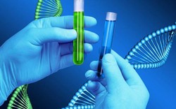 Xét nghiệm DNA tìm bố đẻ, người đàn ông không tin nổi khi nhận kết quả