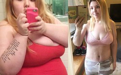 Nữ sinh "thùng phi" 186kg to như khinh khí cầu phải cắt dạ dày để giảm cân