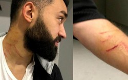 Thổ Nhĩ Kỳ: Cầu thủ mang dao cứa cổ đối phương ngay trên sân