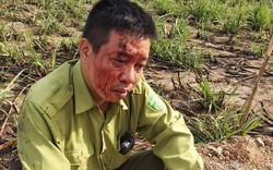 Đắk Lắk: Tạm giữ nhóm lâm tặc hành hung kiểm lâm Vườn quốc gia