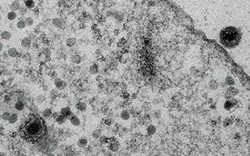 Phát hiện một loại virus mới có gen kỳ lạ khoa học chưa từng biết đến