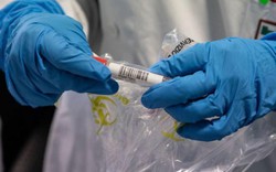NÓNG: Hôm nay (16/3), Mỹ bắt đầu thử nghiệm vaccine chống Covid-19