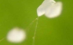 Hoa Ưu Đàm qua kính hiển vi trong như pha lê