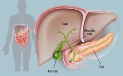 Làm sao bảo vệ gan?