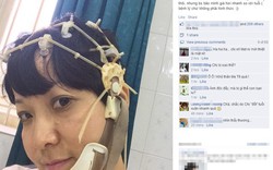 MC Thảo Vân nhập viện vì teo thùy não