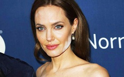 Angelina Jolie mất điểm vì mặt loang lổ, lem nhem