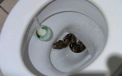 Kinh hoàng người phụ nữ bị rắn cắn vào mông trong nhà vệ sinh