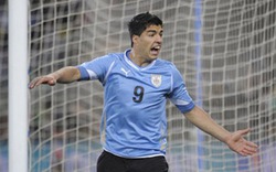 Uruguay: Ảnh vết cắn của cầu thủ Suarez bị chỉnh sửa