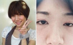 Nữ diễn viên Nhật treo cổ tự sát nhưng không thành, mặt bị biến dạng