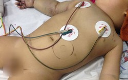 Bé 2 tuổi bị rắn cắn thương tâm, Bộ trưởng Bộ Y tế kêu gọi lòng hảo tâm