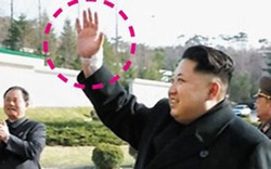 Rộ tin ông Kim Jong-un bị chấn thương cổ tay