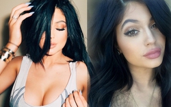Em gái 17 tuổi của Kim Kardashian thừa nhận bơm môi