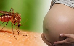 Mẹ bầu cần làm gì để phòng tránh virus Zika?