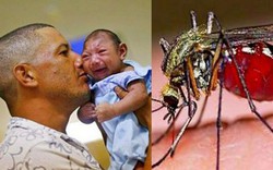 Phụ nữ mang thai nhiễm virus Zika nguy hiểm như thế nào?