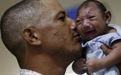 Virus gây teo não Zika đã phủ 1/3 thế giới