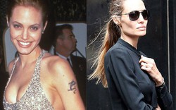 Loạt ảnh Angelina Jolie gầy trơ xương vì bệnh biếng ăn