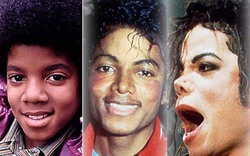 25 năm "dao kéo" ấn tượng của vua pop Michael Jackson