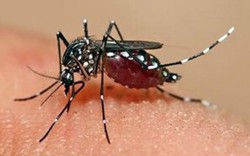 Ngỡ ngàng vì... virus Zika