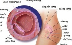 Người phụ nữ lấy 2 đời chồng không thể có nổi mụn con