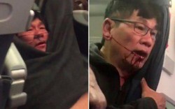 United Airlines thiệt hại 1 tỷ USD vì đuổi bác sĩ gốc Việt khỏi máy bay
