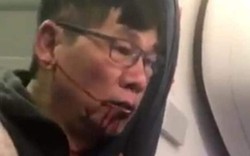 United Airlines đuổi bác sĩ gốc Việt khỏi máy bay đúng sai thế nào?