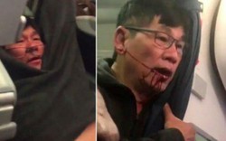 "Hãng United Airlines có thể còn chưa dám nghĩ đến thiệt hại"