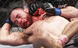 7 hình ảnh chứng minh UFC không dành cho kẻ nhát gan