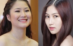 Mỹ nhân showbiz Việt công khai thừa nhận phẫu thuật thẩm mỹ