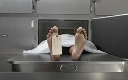 Cách khám nghiệm tử thi mới không cần mổ xác chết