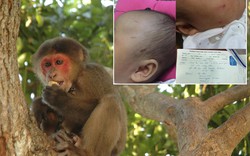 Kinh hãi: Khỉ đực vào nhà tấn công bé sơ sinh ngay giữa Thủ đô