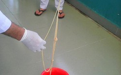 Quảng Nam: Lại xổ thành công sán xơ mít dài đến 10 mét