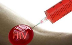 Hận tình, bác sĩ dùng máu nhiễm HIV trả thù bạn gái