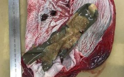 Anh: Mổ bụng cá heo, phát hiện thứ phải mất 70 năm để phân hủy