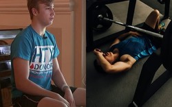 Nam thiếu niên đối mặt với bệnh chết người vì tập gym quá đà