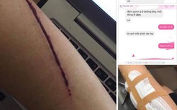 Xôn xao thông tin thiếu nữ bị rạch tay, cướp túi xách ở Hà Nội