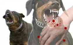 Cà Mau: Xuất hiện ổ dịch bệnh dại trên chó, cắn người hàng loạt