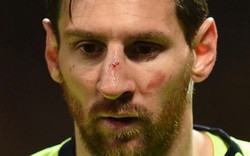 Barcelona nhận tin "sét đánh" về Messi