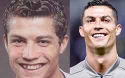 CR7, Beckham, Ronaldinho... điển trai hơn nhờ thẩm mỹ, sửa răng