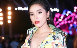 Hoa hậu Kỳ Duyên đăng hình thân thể bầm dập khiến fan xót xa