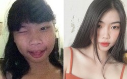 Nữ sinh lớp 12 Tây Ninh đẹp lên thần kỳ tới mức bị bạn bè nghi thẩm mỹ