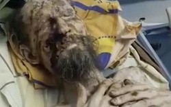 Nga: Người đàn ông trông như xác ướp, bị gấu nhốt trong hang cả tháng làm thức ăn?