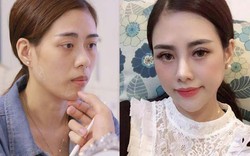 Sửa khuôn mặt thường thường bậc trung, cô gái tự tin xinh như hot girl