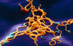 Cận cảnh vi khuẩn chết người Ebola đẹp ngỡ ngàng