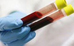 Vụ nhân bản kết quả xét nghiệm máu:  Sai phạm do “lỗi hệ thống” 