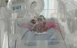 Bé sơ sinh suýt bị chôn sống giảm cân so với lúc mới vào viện