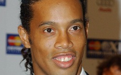 Mơ &#34;nụ cười tỏa nắng&#34;, Ronaldinho đi chữa... răng vẩu