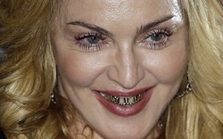 Ngã ngửa với răng bọc vàng của Madonna