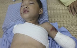 Phú Thọ: Bé trai 5 tuổi bị gấu nuôi cắn nát 2 tay 