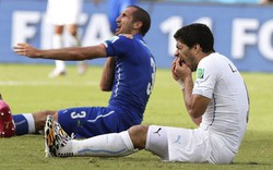 FIFA bất ngờ “lật lọng” trong vụ Suarez cắn người