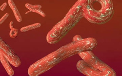 Cảnh báo bệnh sốt xuất huyết do virus Ebola